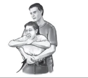 Heimlich manevrası: Arkadan sarılarak karın bölgesine yukarı doğru ani basınç uygula